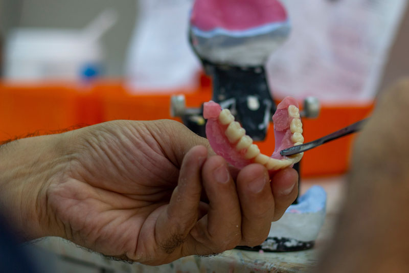 a dentist working on making a full arch dental implant prosthesis.