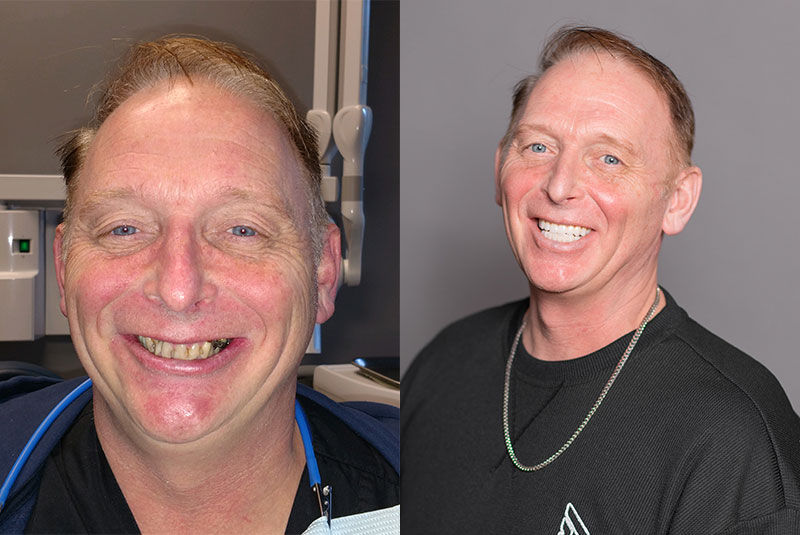 patient transformation - before and after photos
