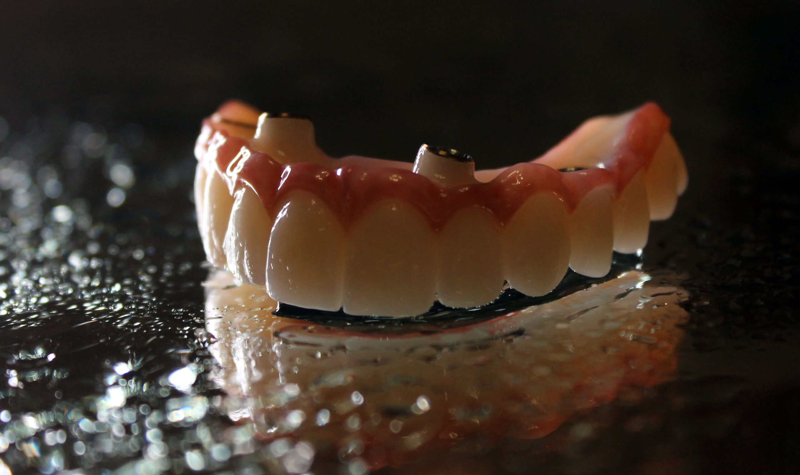 Am I Able To Get A Zirconia Prosthesis For My Full Arch Dental Implants In Oregon City, OR?