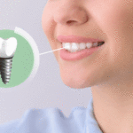 Young woman with implanted teeth on color background, closeup