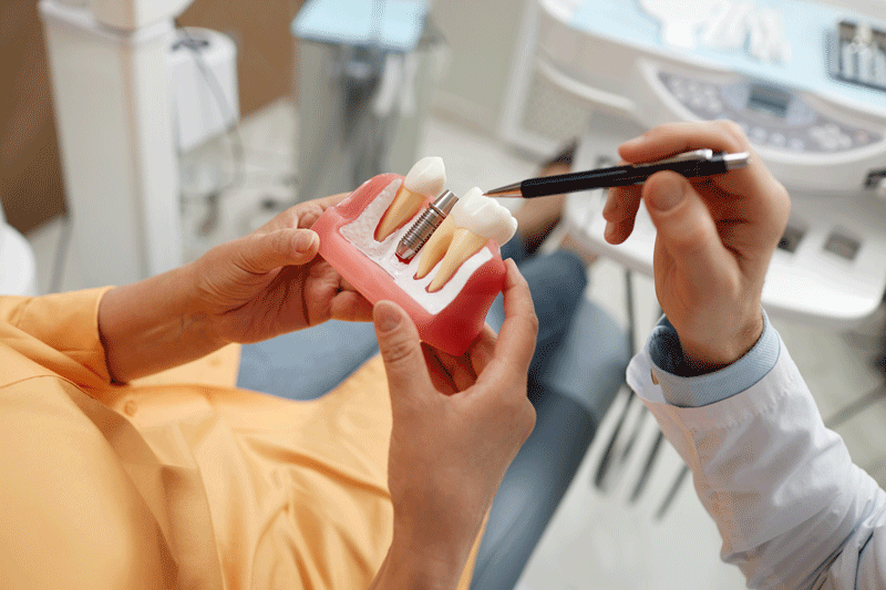 For Dental Implants, How Long Should A Temporary Prosthesis Be Worn?