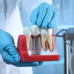 The image shows a person in blue gloves holding a dental implant model next to natural teeth, demonstrating how dental implants work. The setting appears to be a dental clinic.