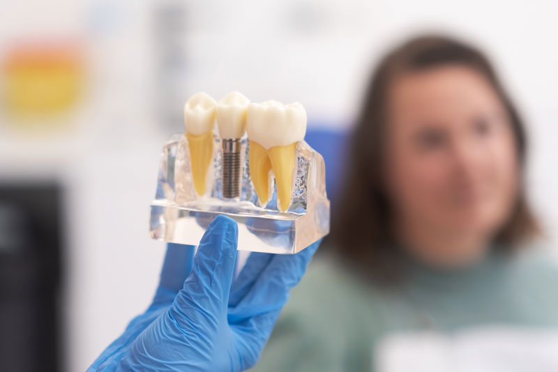 close-up patient listening to a female dentist explaining a dental implant treatment plan. The focus is teeth implant model in dentists hand