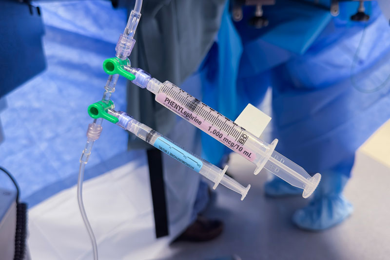 Exploring IV Sedation in Endodontics: A Comprehensive Guide in Portland, OR